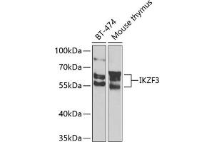 Western blot analysis of extracts of various cell lines, using IKZF3 Antibody (ABIN6130489, ABIN6142290, ABIN6142291 and ABIN6223116) at 1:1000 dilution. (IKZF3 抗体  (AA 280-450))