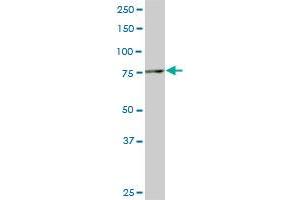 Western Blotting (WB) image for anti-SMAD Specific E3 Ubiquitin Protein Ligase 1 (SMURF1) (AA 165-268) antibody (ABIN566098)