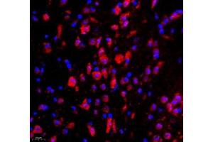 Immunofluorescence of paraffin embedded mouse corpus striatum using WDR81 (ABIN7076221) at dilution of 1: 700 (400x lens) (WDR81 抗体)