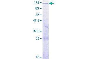 VPS39 Protein (AA 1-875) (GST tag)