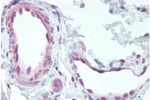 Anti-EDNRB antibody  ABIN1048560 IHC staining of human vessels.