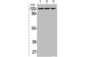 Western Blot analysis of HELA A431 cells using Phospho-EphB1/2 (Y594/604) Polyclonal Antibody (EPH Receptor B1 抗体  (pTyr594, pTyr604))