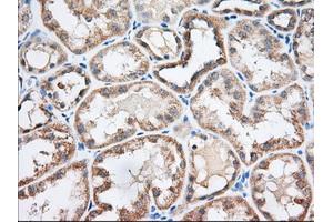 Immunohistochemical staining of paraffin-embedded Human liver tissue using anti-EIF2S1 mouse monoclonal antibody. (EIF2S1 抗体)