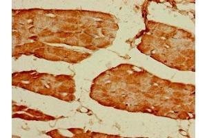 Immunohistochemistry of paraffin-embedded human skeletal muscle tissue using ABIN7153992 at dilution of 1:100 (GRIN2C 抗体  (AA 908-1007))