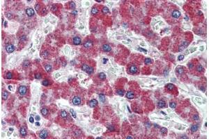 Human Liver: Formalin-Fixed, Paraffin-Embedded (FFPE) (PAR1 抗体  (AA 24-37))