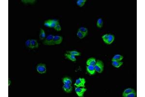 Immunofluorescent analysis of MCF-7 cells using ABIN7174993 at dilution of 1:100 and Alexa Fluor 488-congugated AffiniPure Goat Anti-Rabbit IgG(H+L) (USMG5 抗体  (AA 2-58))