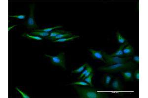 Immunofluorescence of purified MaxPab antibody to C13orf18 on HeLa cell. (C13orf18 抗体  (AA 1-595))