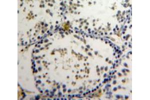 Used in DAB staining on fromalin fixed paraffin-embedded Testis tissue (ZNF384 抗体  (AA 307-540))