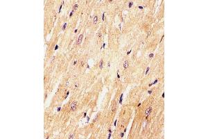 (ABIN6242465 and ABIN6577972) staining (Mouse) Med15 in Mouse heart tissue sections by Immunohistochemistry (IHC-P - paraformaldehyde-fixed, paraffin-embedded sections). (MED15 抗体  (C-Term))