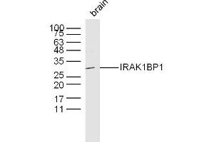 Mouse brain lysates probed with IRAK1BP1 Polyclonal Antibody, Unconjugated  at 1:300 dilution and 4˚C overnight incubation. (IRAK1BP1 抗体  (AA 51-150))