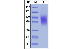 Mouse CD47, His Tag on  under reducing (R) condition. (CD47 Protein (CD47) (AA 19-140) (His tag))