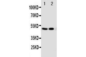Anti-VDR antibody, Western blotting Lane 1: MCF-7 Cell Lysate Lane 2: HELA Cell Lysate (Vitamin D Receptor 抗体  (C-Term))