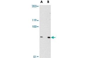 Western blot analysis of SPG11 in mouse heart tissue lysate with SPG11 polyclonal antibody  at (A) 0. (SPG11 抗体  (C-Term))