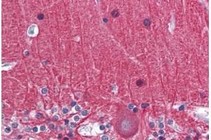 Human Brain, Cerebellum: Formalin-Fixed, Paraffin-Embedded (FFPE) (TUBA3C 抗体  (AA 1-419))