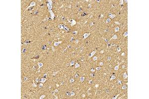 IHC analysis of ATP1B1 using anti-ATP1B1 antibody (ABIN7602014).