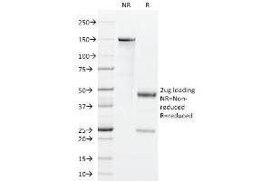 SDS-PAGE Analysis Purified GM-CSF Rat Monoclonal Antibody (BVD2-21C11). (GM-CSF 抗体)