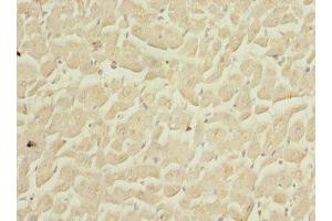 Immunohistochemistry (IHC) image for anti-COP9 Signalosome Complex Subunit 3 (COPS3) (AA 194-423) antibody (ABIN7148495)
