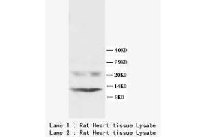 Image no. 1 for anti-Phospholamban (PLN) (N-Term) antibody (ABIN1495356) (Phospholamban 抗体  (N-Term))