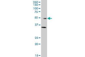 GATA3 monoclonal antibody (M01), clone 1C1 Western Blot analysis of GATA3 expression in A-431 . (GATA3 抗体  (AA 103-200))