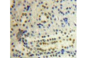 Used in DAB staining on fromalin fixed paraffin-embedded Kidney tissue (PSMC3 抗体  (AA 2-439))