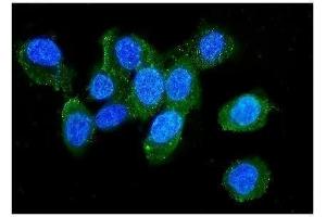 IF analysis of LCP1 using anti-LCP1 antibody (ABIN6719421). (LCP1 抗体)