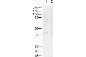 Western blot using  Affinity Purified anti-ZIC2 antibody shows detection of a band ~55 kDa (arrowhead) corresponding to ZIC2 in lysates from (lane 1) mouse brain and (lane 2) rat brain. (ZIC2 抗体  (AA 189-206))