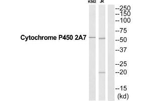 Western Blotting (WB) image for anti-Cytochrome P450, Family 2, Subfamily A, Polypeptide 7 (CYP2A7) (Internal Region) antibody (ABIN1852656) (CYP2A7 抗体  (Internal Region))
