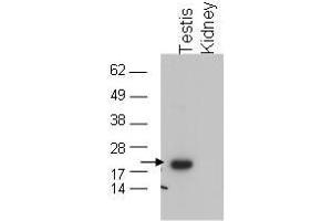 Image no. 1 for anti-Glutathione Peroxidase 4 (GPX4) (C-Term) antibody (ABIN199918) (GPX4 抗体  (C-Term))