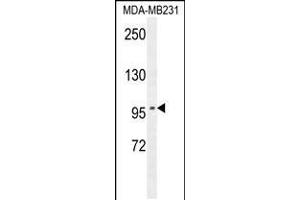 Western blot analysis in MDA-MB231 cell line lysates (35ug/lane). (ST7 抗体  (AA 169-197))