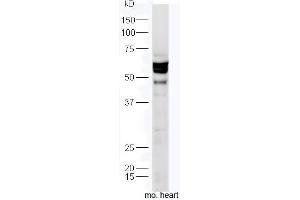 Mouse heart lysates probed with Anti-TXA2R Polyclonal Antibody, Unconjugated  at 1:300 in 4˚C. (TBXA2R 抗体  (AA 51-150))