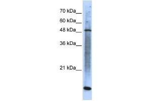 WB Suggested Anti-SMARCE1 Antibody Titration: 0. (SMARCE1 抗体  (N-Term))