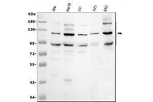 Western blot analysis of PML using anti-PML antibody (ABIN4886699). (PML 抗体  (N-Term))