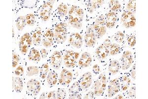 Immunohistochemistry analysis of paraffin-embedded human stomach using CXCR7 Polyclonal Antibody at dilution of 1:100. (CXCR7 抗体)