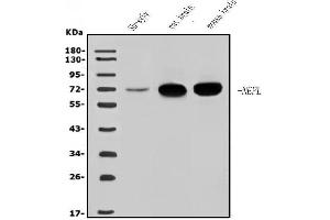 Western blot analysis of NEFL/NF-L using anti-NEFL/NF-L antibody (ABIN7601626).