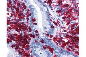 Anti-CORO1A antibody IHC of human small intestine.