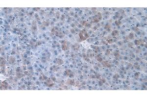 Immunohistochemistry (IHC) image for anti-Orosomucoid 1 (ORM1) (AA 19-186) antibody (ABIN7428035)