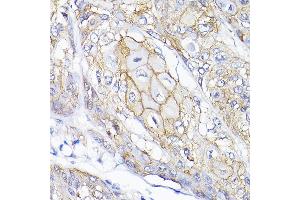 Immunohistochemistry (IHC) image for anti-Sema Domain, Immunoglobulin Domain (Ig), Transmembrane Domain (TM) and Short Cytoplasmic Domain, (Semaphorin) 4F (SEMA4F) (AA 280-420) antibody (ABIN6147521)