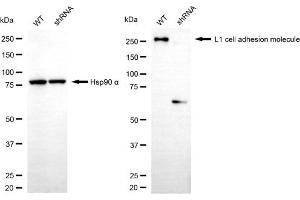 Western blotting analysis using L1 cell adhesion molecule antibody (ABIN7799222).