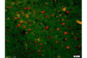 Formalin-fixed and paraffin-embedded rat brain labeled with Anti-HSTF2/HSF2 Polyclonal Antibody, Unconjugated (ABIN686137) 1:200, overnight at 4°C, The secondary antibody was Goat Anti-Rabbit IgG, Cy3 conjugated used at 1:200 dilution for 40 minutes at 37°C. (HSF2 抗体  (AA 401-536))