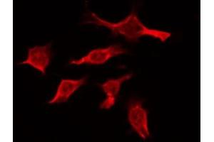 ABIN6274395 staining Hela by IF/ICC. (RBM26 抗体  (Internal Region))