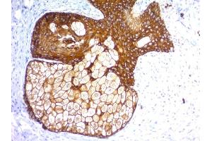 Formalin-fixed, paraffin-embedded human Skin stained with Pan-Cytokeratin Recombinant Rabbit Monoclonal Antibody (KRTH/1576R + KRTL/1577R). (Recombinant KRT77, KRT76 抗体)