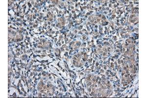 Immunohistochemistry (IHC) image for anti-thromboxane A Synthase 1 (Platelet) (TBXAS1) antibody (ABIN1501383)