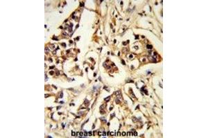 Immunohistochemistry (IHC) image for anti-rho GTPase Activating Protein 18 (ARHGAP18) antibody (ABIN3003783) (ARHGAP18 抗体)