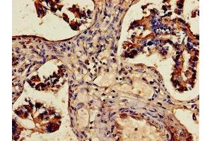 Immunohistochemistry of paraffin-embedded human lung tissue using ABIN7143677 at dilution of 1:100 (ALDH3A1 抗体  (AA 210-453))