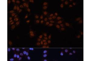 Immunofluorescence analysis of HeLa cells using GTF2I Polyclonal Antibody at dilution of 1:100. (GTF2I 抗体)
