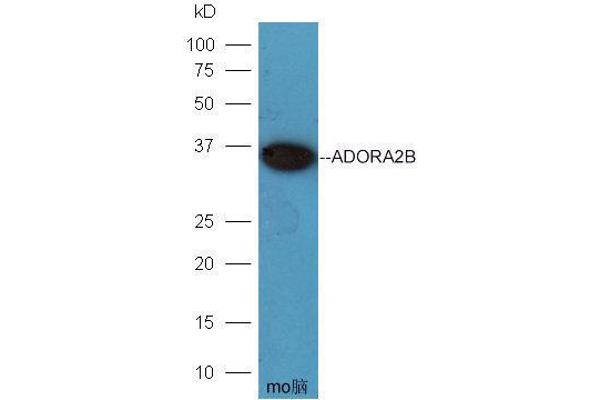 Adenosine A2b Receptor 抗体  (AA 101-200)