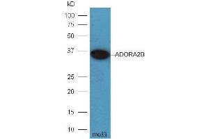 Mouse brain lysates probed with Rabbit Anti-ADORA2B Polyclonal Antibody  at 1:5000 90min in 37˚C. (Adenosine A2b Receptor 抗体  (AA 101-200))