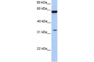 Western Blotting (WB) image for anti-Post-GPI Attachment To Proteins 3 (PGAP3) antibody (ABIN2459368)