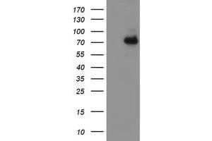 HEK293T cells were transfected with the pCMV6-ENTRY control (Left lane) or pCMV6-ENTRY ALOX15 (Right lane) cDNA for 48 hrs and lysed. (ALOX15 抗体)