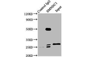 Immunoprecipitating SMNDC1 in Hela whole cell lysate Lane 1: Rabbit control IgG (1 μg) instead of ABIN7171028 in Hela whole cell lysate. (SMNDC1 抗体  (AA 1-238))